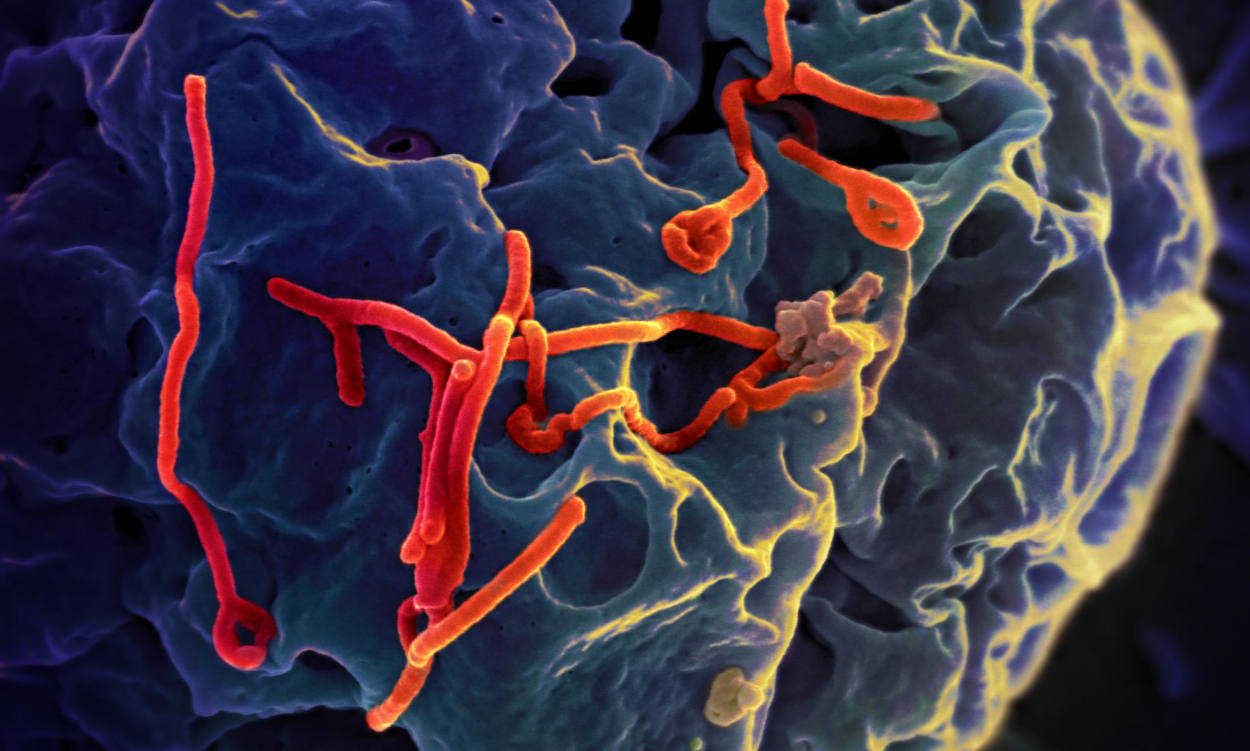 Ebolavirus bleibt nach dem Fieber im Gehirn