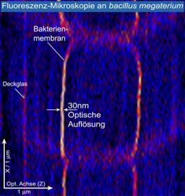 Göttinger Forscher vervielfachen Auflösungsvermögen von Lichtmikroskopen