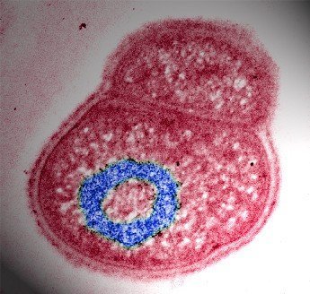 Ungewöhnliche DNA-Struktur lässt Super-Bakterium das Tausendfache einer tödlichen
         Strahlendosis überstehen