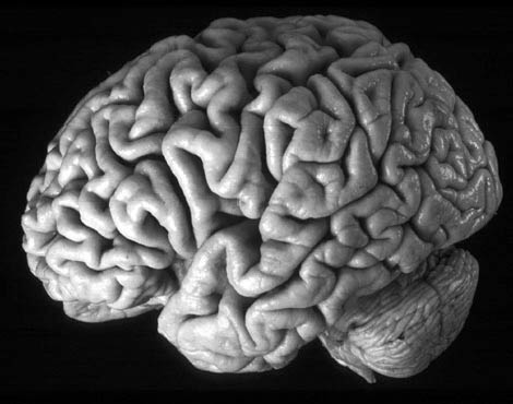 Forscher schlagen Alarm: In den Industrieländern ist der IQ auf Talfahrt