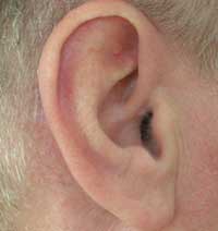 Musik gegen den Tinnitus: Heidelberger Wissenschaftler haben eine wirkungsvolle Therapie
gegen quälende Ohrgeräusche entwickelt