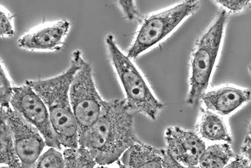 Wie künstliches Erbgut den Zorn des Immunsystems auf Krebszellen lenkt