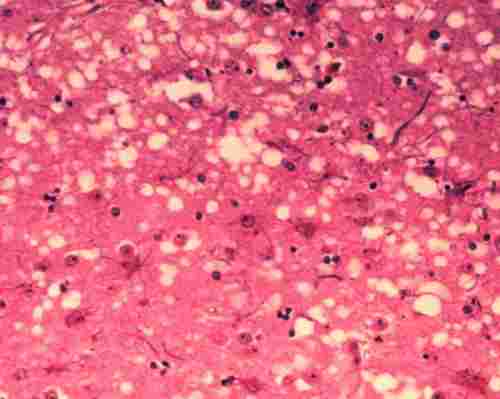 Neue Zweifel an Prionhypothese