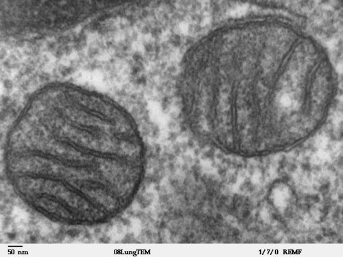 Ein Organell auf Abwegen