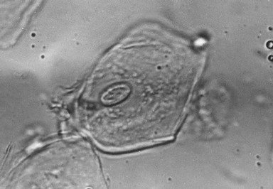 Kontroverse um Radarstrahlung