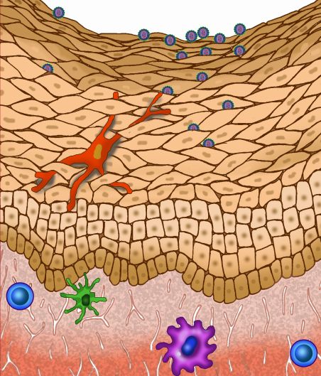 HIV überwindet auch gesundes Vaginalgewebe