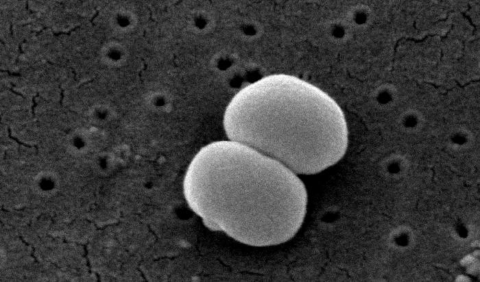 Was Biofilme entzaubert