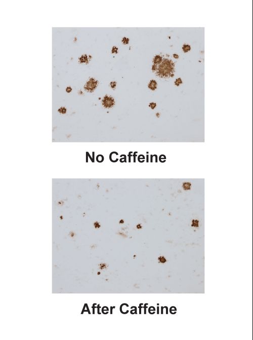 Mit Koffein gegen das Vergessen