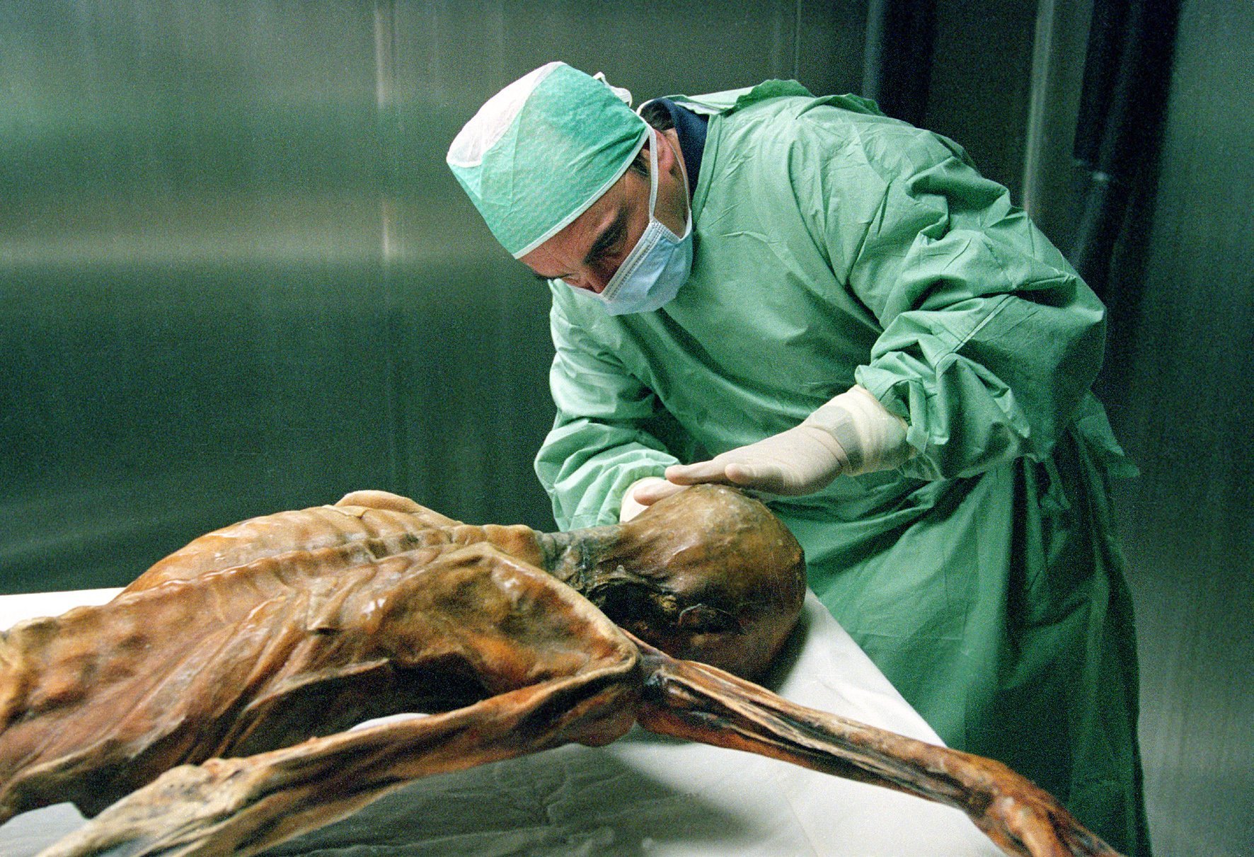 Trockene Haut konservierte Ötzi