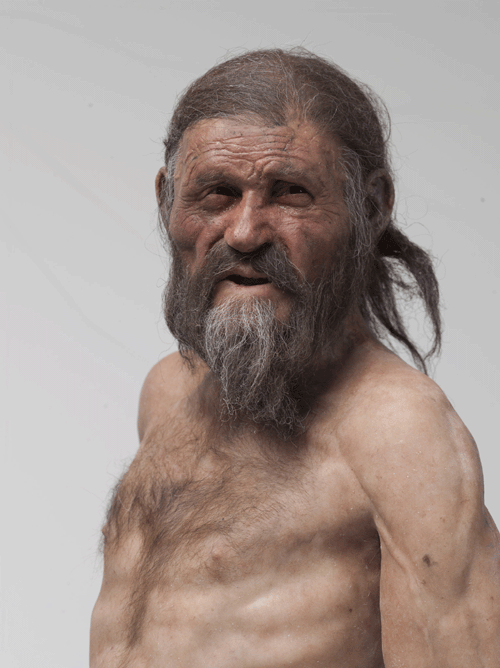 Die Leiden des Ötzi
