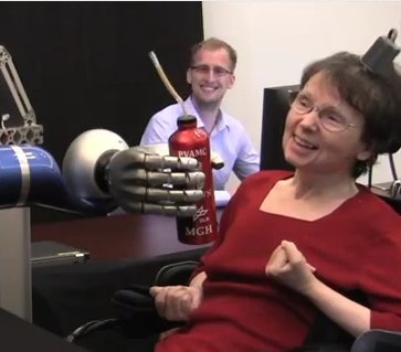 Video der Woche: Gelähmte Frau steuert Roboterarm mit Willenskraft