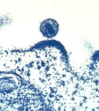 Dem Aids-Erreger den Hahn abgedreht