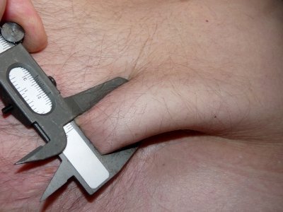 Müde Fettzellen machen dick
