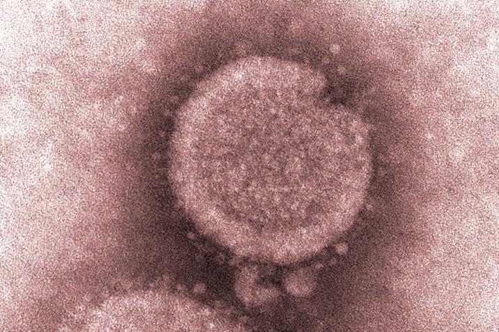 Neue Vogelgrippe H7N9 ist resistent