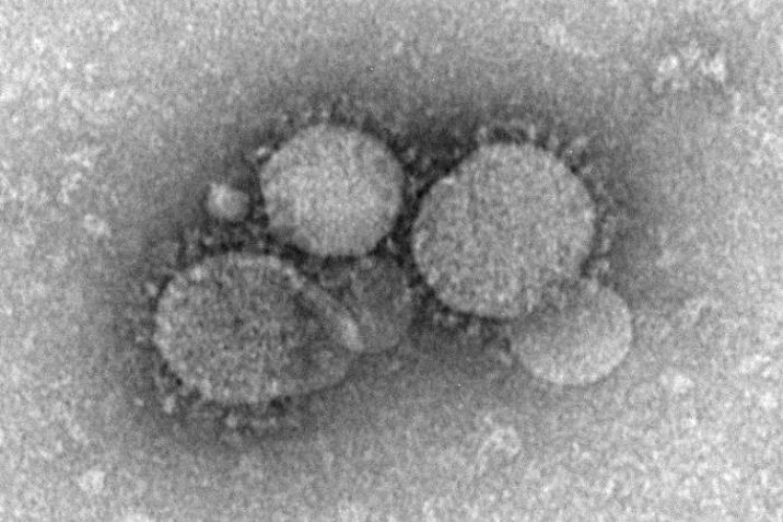 Neues Virus: Hoffnung auf Therapie