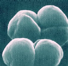 Erdgeschichtliches Rekord-Massensterben: Waren Mikroben schuld?
