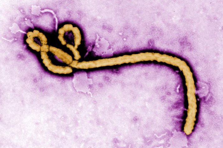 Wie Ebola die Abwehr der Zellen blockiert