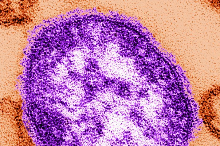 Masern-Epidemie: Sind Impfmuffel schuld?