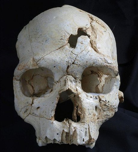 Das älteste bekannte Mordopfer