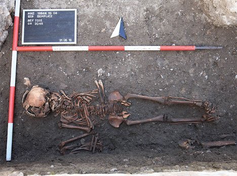 Kam die Syphilis doch nicht aus Amerika?