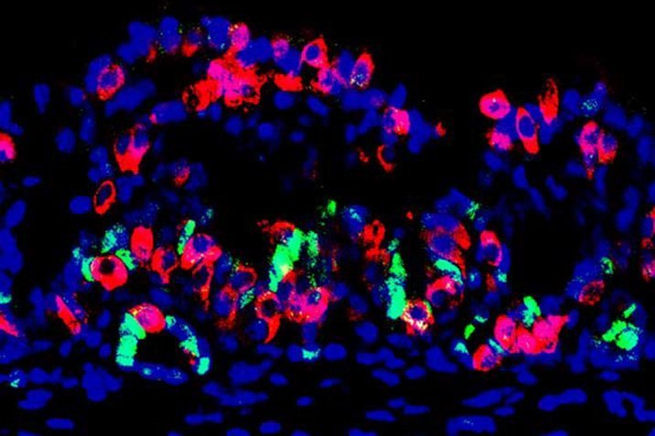 Diabetes: Magenzellen als Insulin-Produzenten