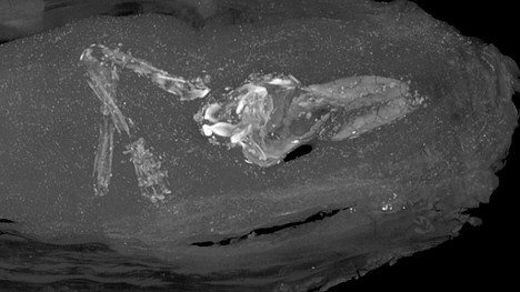Mumifizierter Fötus entdeckt