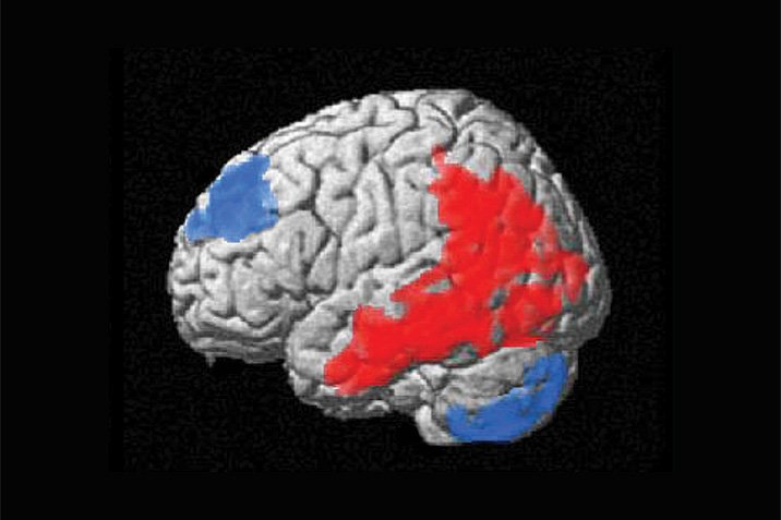 Tiefe Hirnstimulation gegen Magersucht?