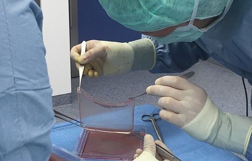 Genmodifizierte Zucht-Haut rettet Leben