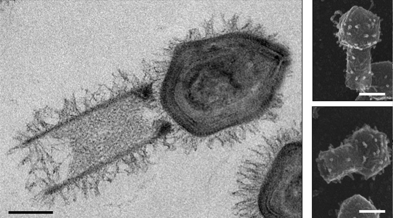 Ungewöhnliche Riesenviren entdeckt