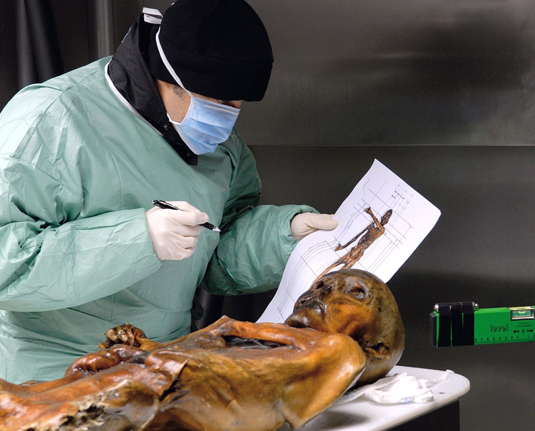 Ötzi hatte verkalkte Gefäße