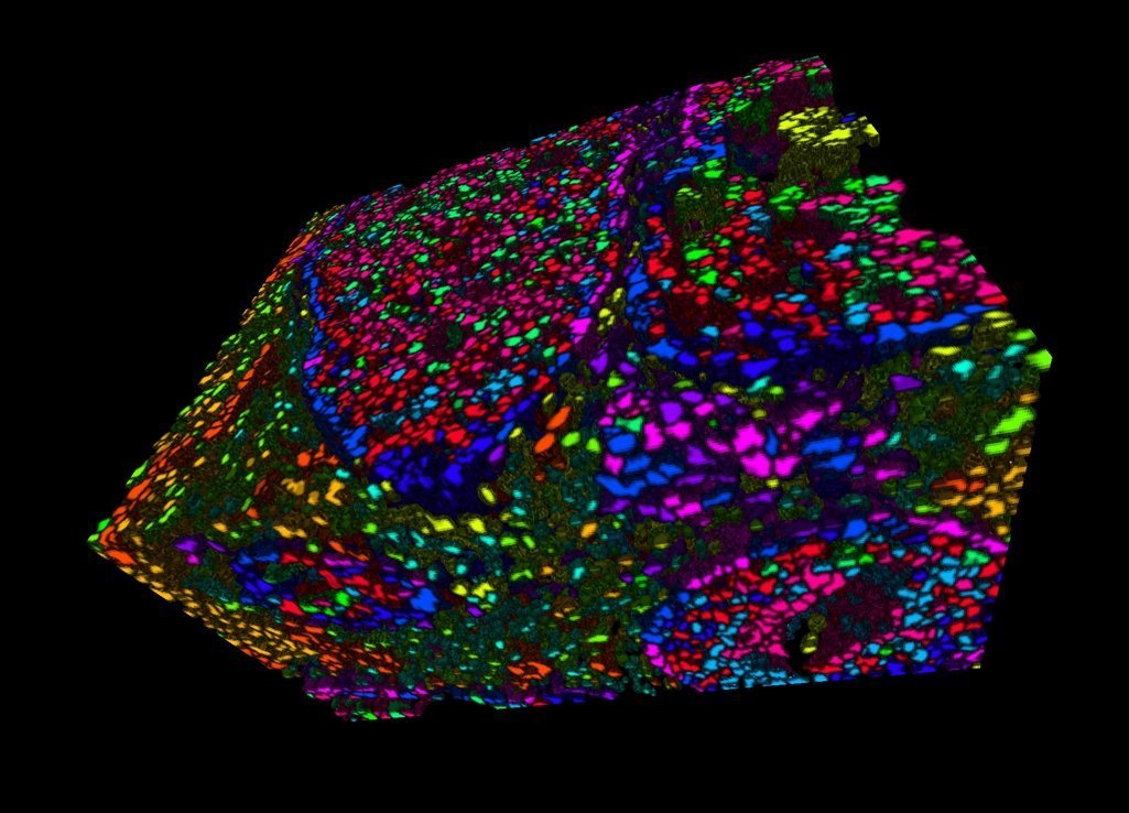 Diagnose per Tumor-Mosaik