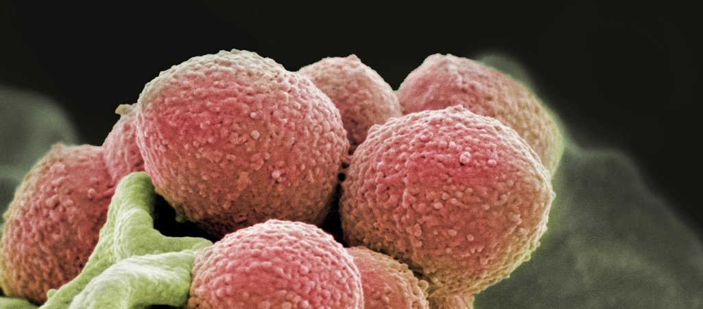 Stillleben mit Streptokokken