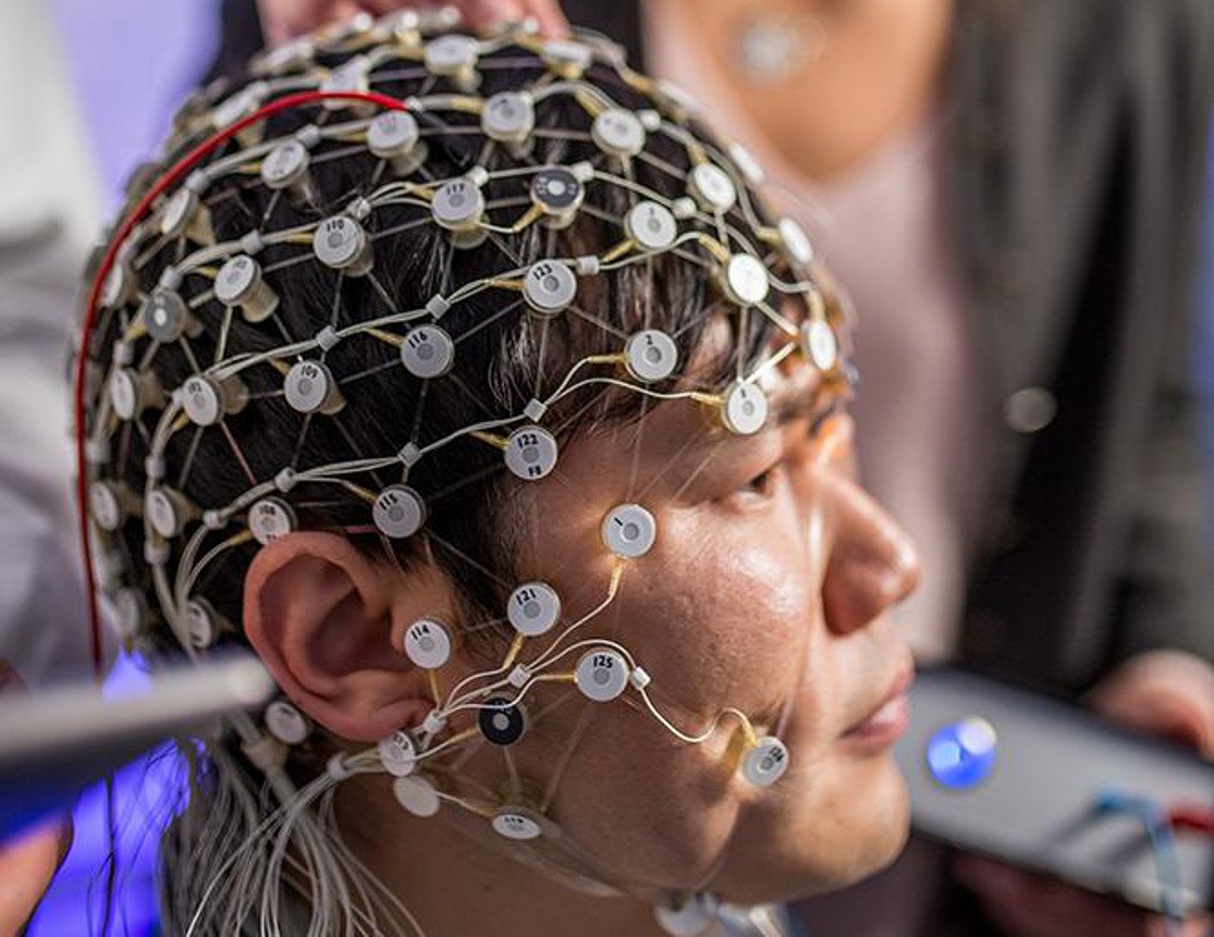 Mit Wechselstrom gegen Depressionen