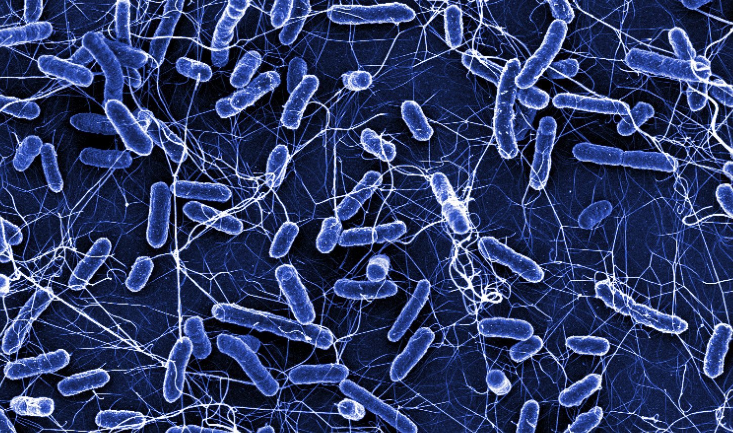 Resistenzen verbreiten sich auch ohne Antibiotika