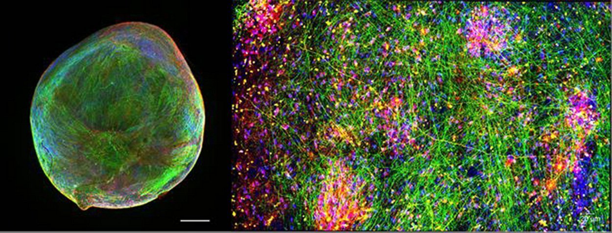 Hirn-Organoid mit lernfähigem Netzwerk