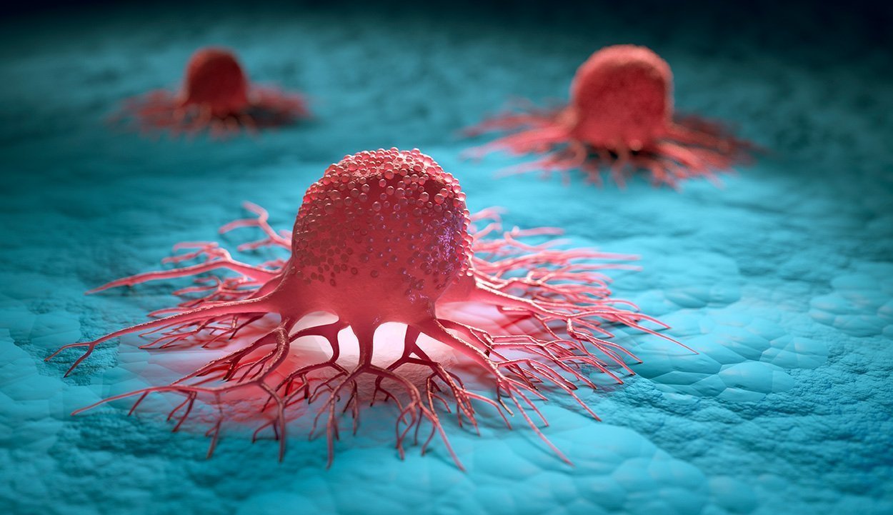 Sauerstoffmangel im Tumor fördert Metastasierung