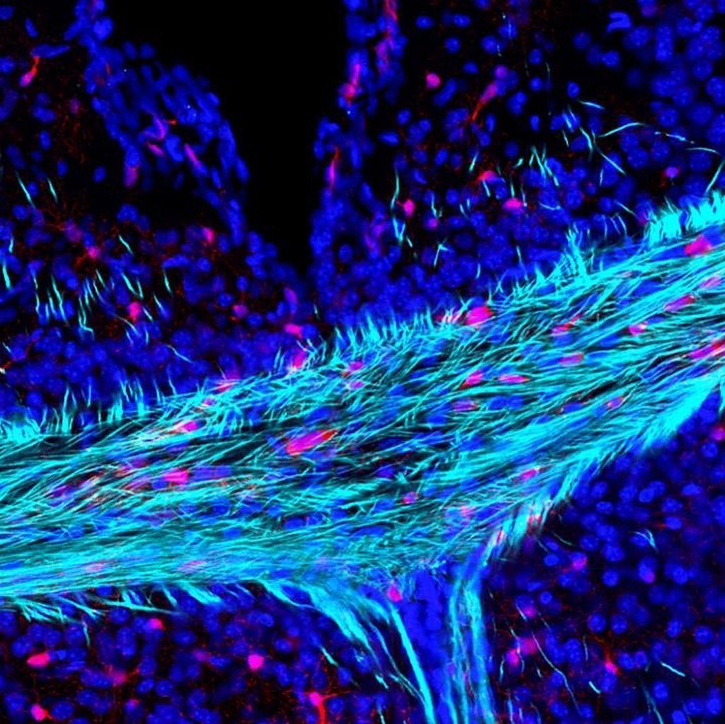 Myelin hält das Gehirn fit