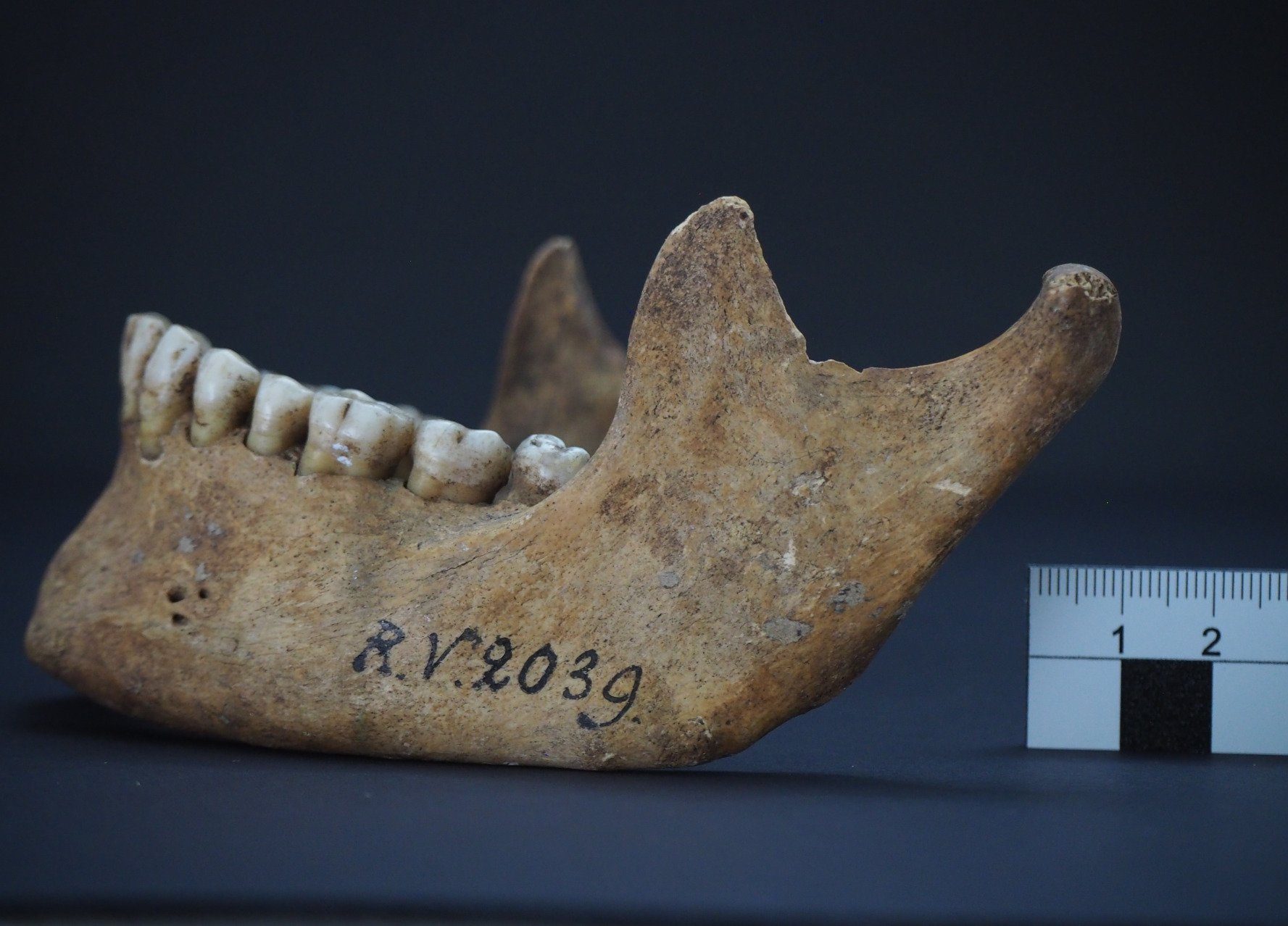 Pest-Infektion vor 5000 Jahren