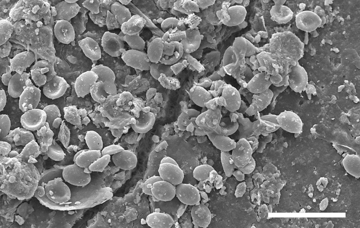 Krankmachende Pilze auf Mikroplastik im Boden