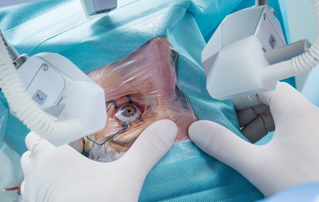 ReLex Smile – das moderne Verfahren des Augenlaserns