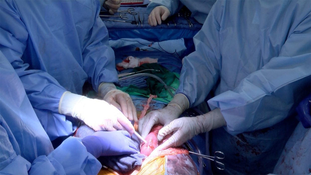 Xenotransplantation von Schweinenieren