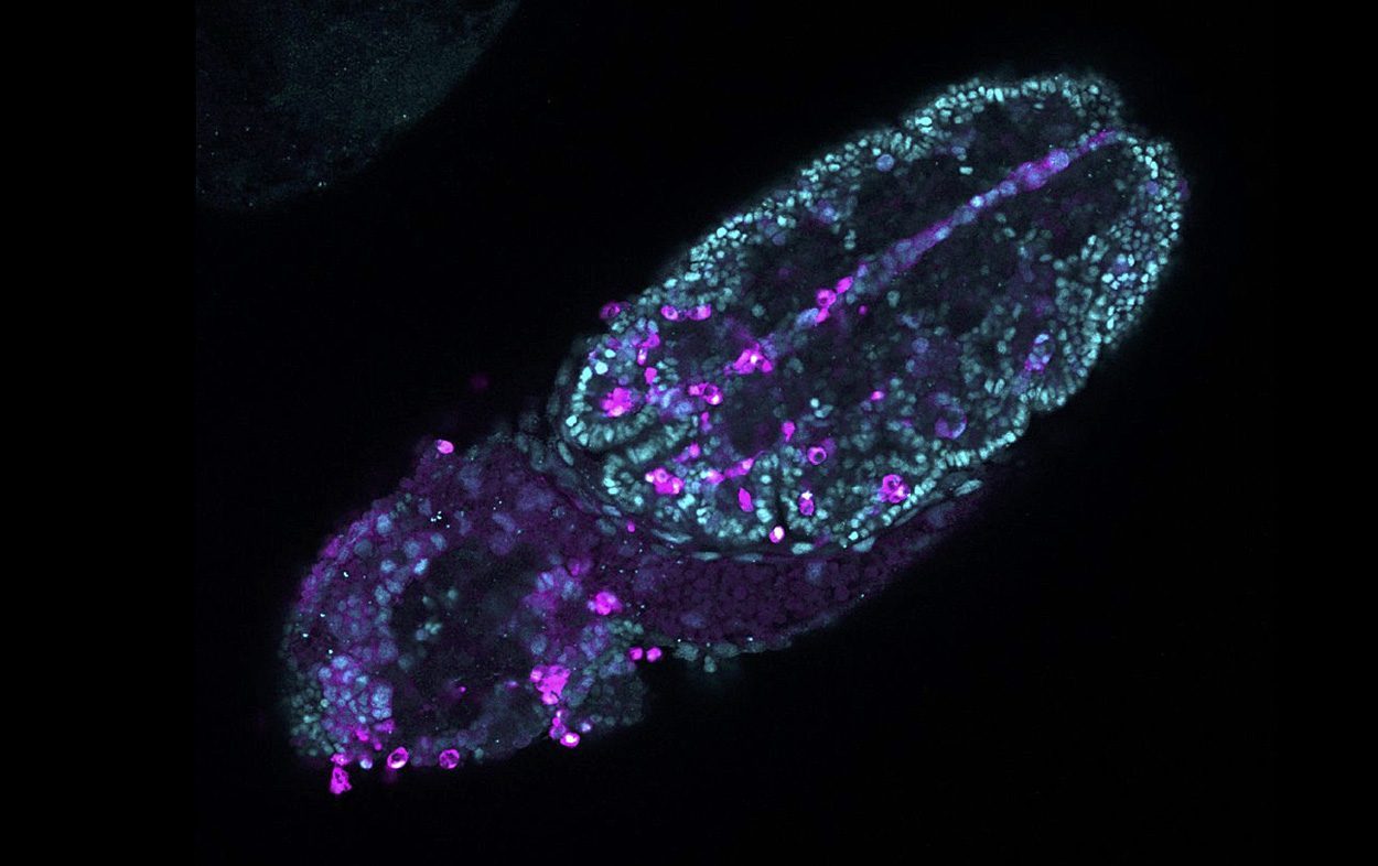 Zellteilung macht den Weg frei für Immunzellen