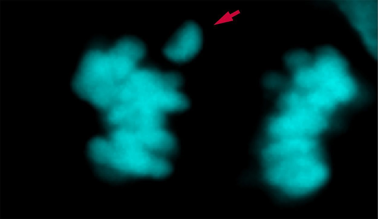 Homo sapiens profitierte von optimierter Zellteilung