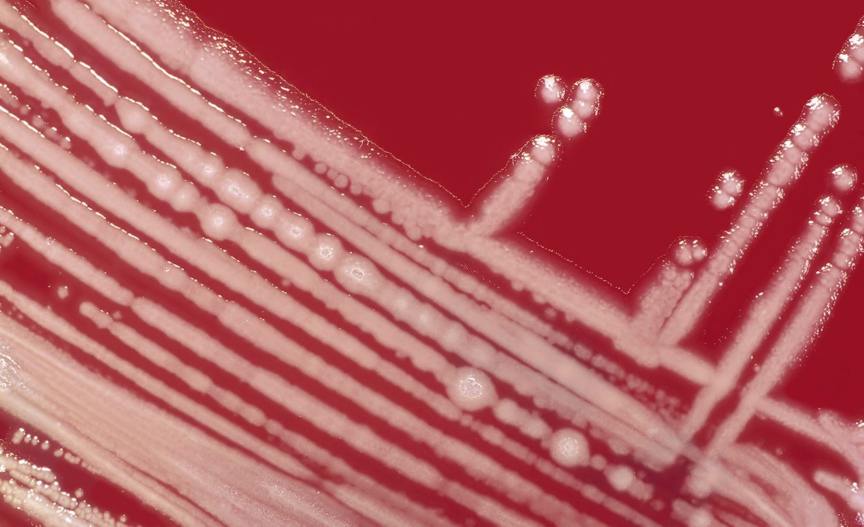 Bakteriengift liefert Ansatzpunkt für neue Antibiotika
