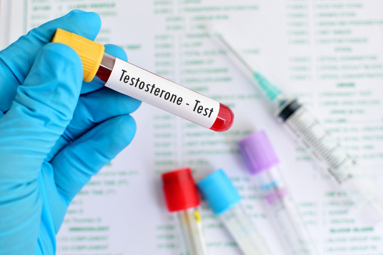 Wenig Testosteron – schweres Covid-19