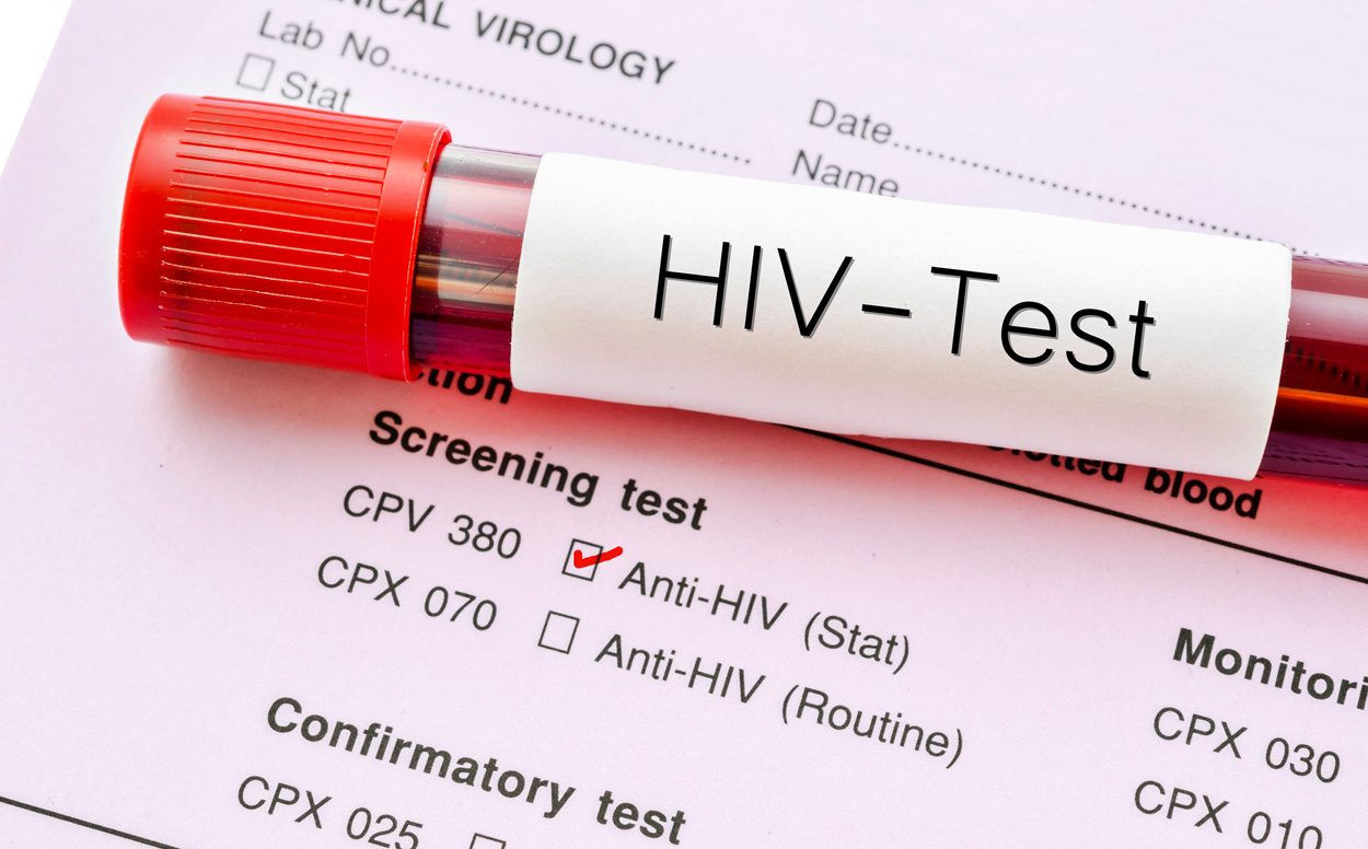 „Düsseldorf-Patient“ von HIV und Leukämie geheilt