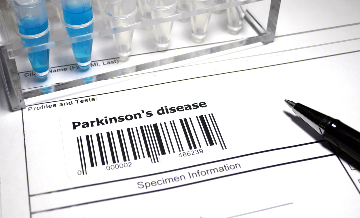 Parkinson-Früherkennung mit Stuhlproben?