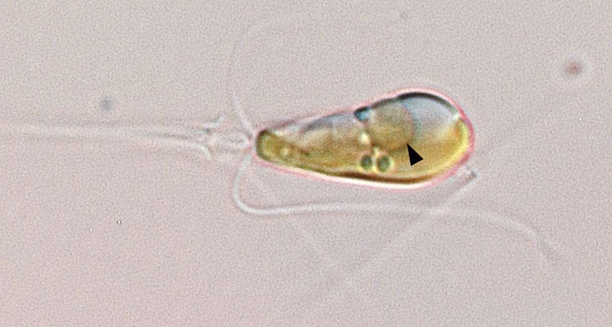 Neu entdecktes Organell fixiert Stickstoff