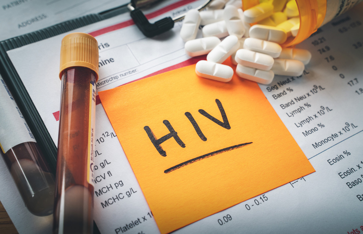 Erster Schritt zur Impfung gegen HIV?