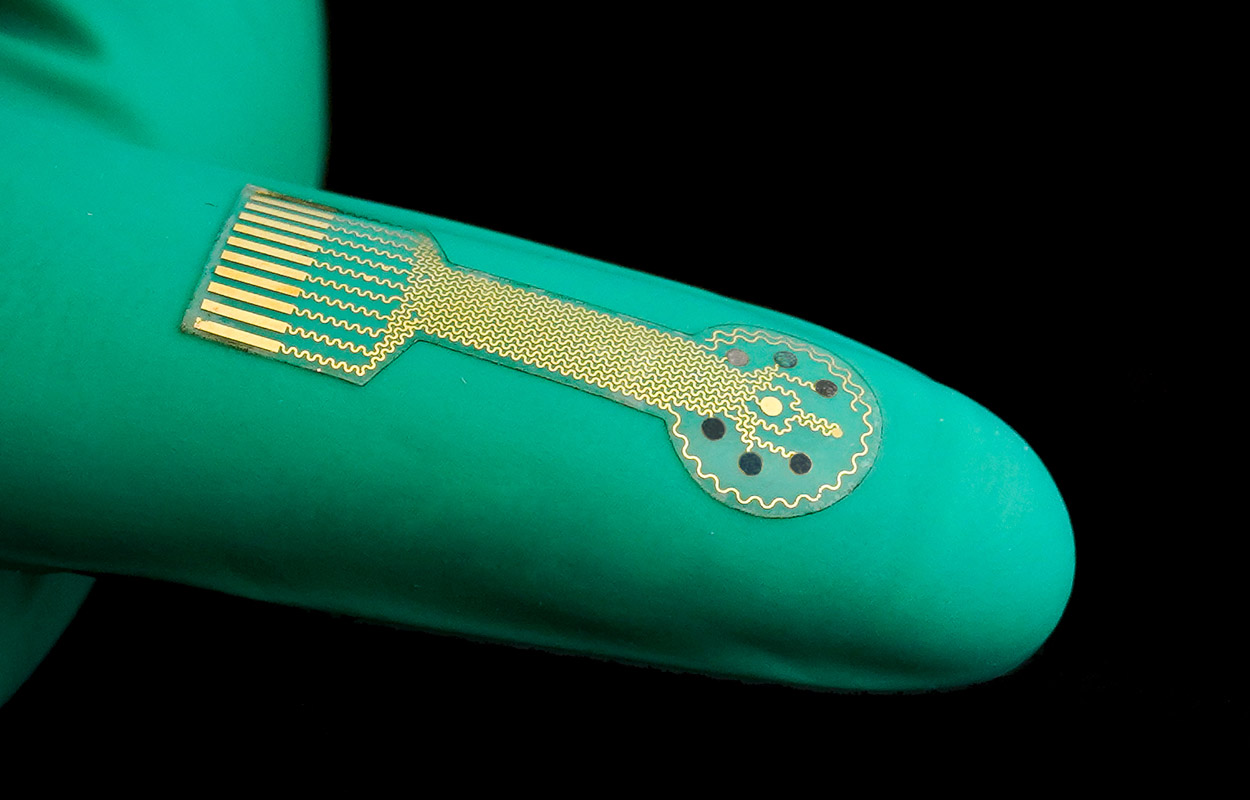 Mit smarten Bandagen gegen chronische Wunden